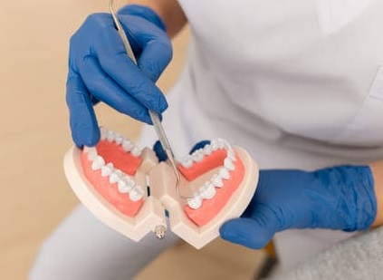 Протезирование зубов без имплантации