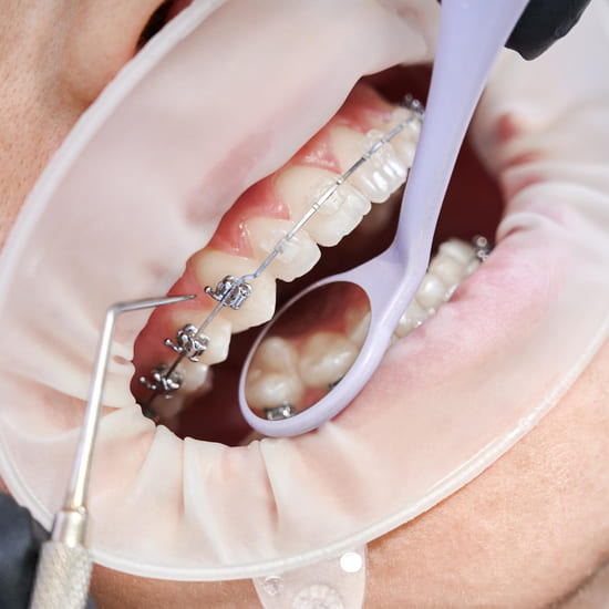 Суть ортодонтического лечения